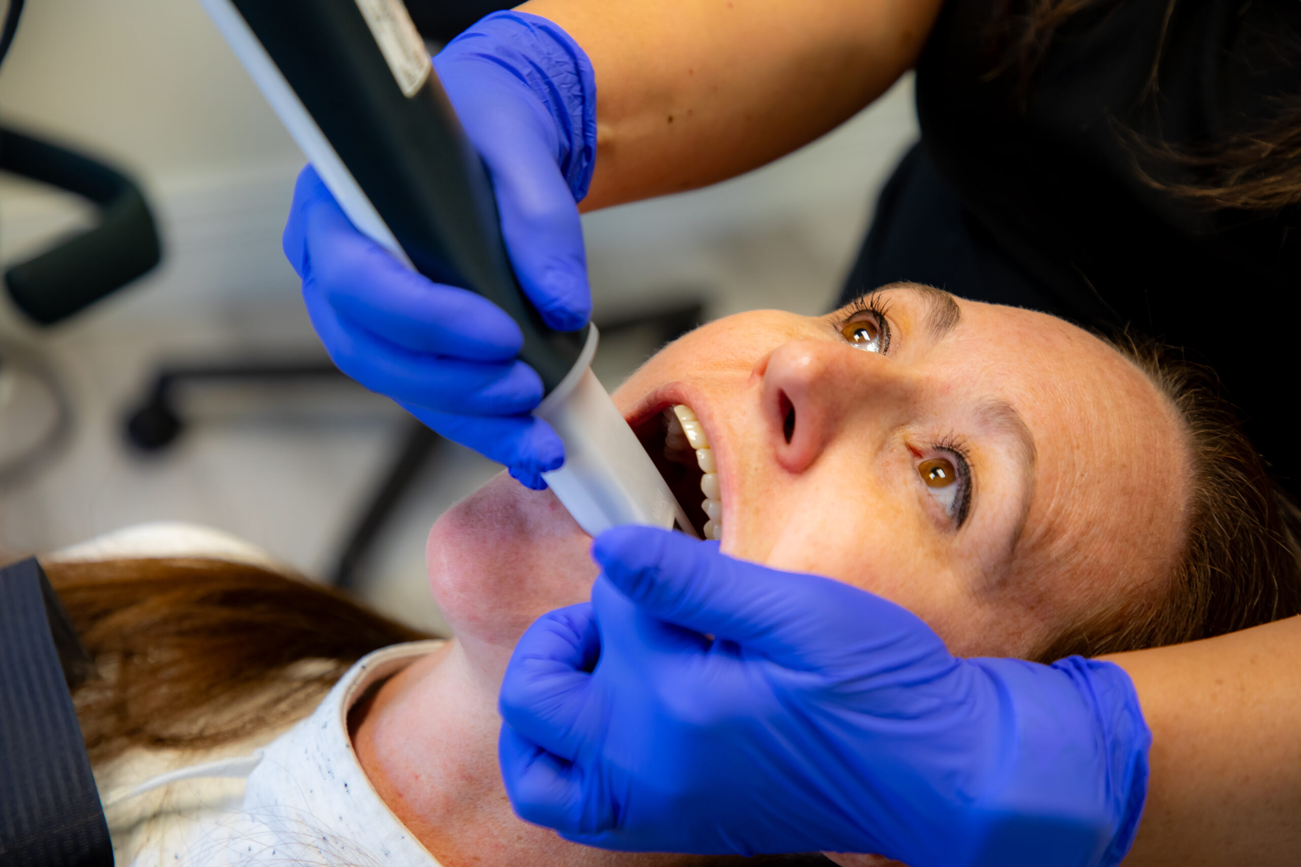 Milagro Dental Intraoral Scanner 707 A dental professional at Milagro Dental in Santa Fe, New Mexico, uses an advanced intraoral scanner to create a precise digital impression of a patient's teeth.