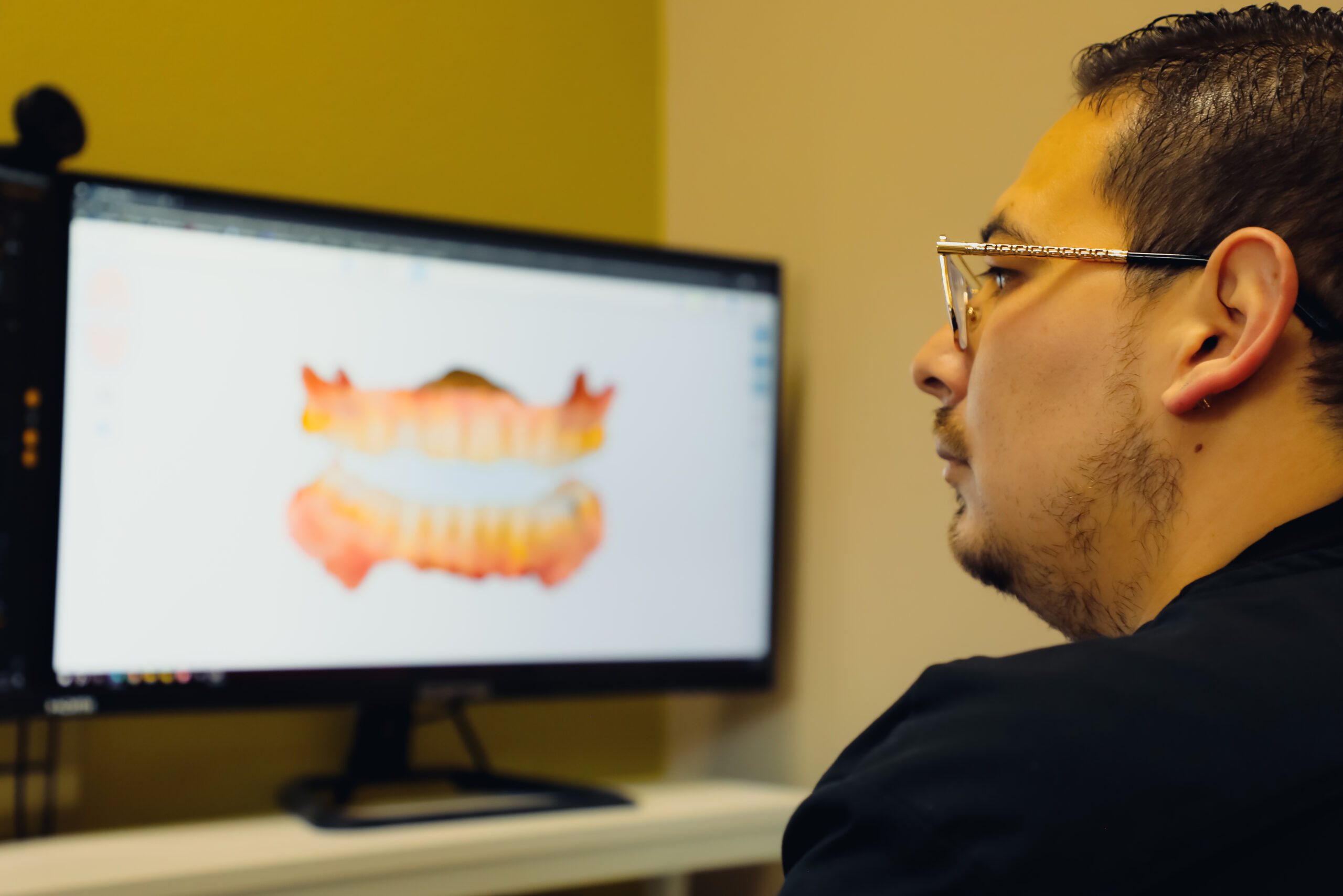 Milagro Dental Advanced Diagnostics 927 A dental professional at Milagro Dental in Santa Fe, New Mexico, reviewing a detailed 3D digital scan of a patient's teeth on a high-resolution monitor.